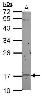 p19 INK4d antibody